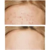 Some By Mi AHA-BHA-PHA 30 Days Miracle Cream 60ml - Image 2