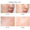 Medi-Peel Herbal Peel Tox Wash Off Type Cream Mask 120g - Image 2