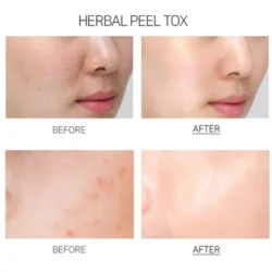 Medi-Peel Herbal Peel Tox Wash Off Type Cream Mask 120g