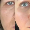MEDICUBE Zero Pore Cream 2.0 50ml — изображение 2