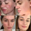 Medicube  Red Acne Succinic Acid Peel 40ml — изображение 2
