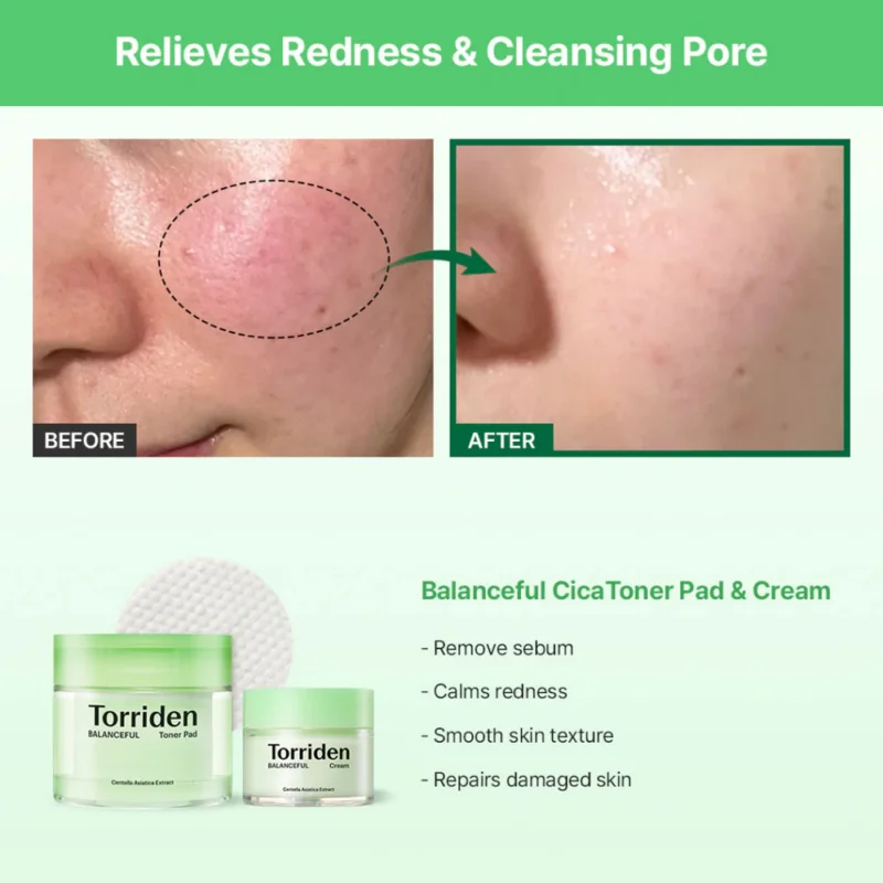 Torriden﻿ Balanceful Cica Toner Pad