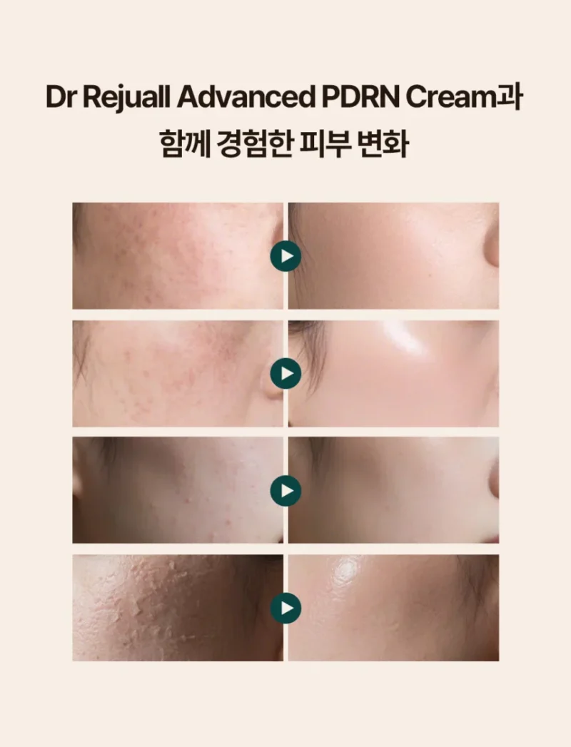 Rejuall Advanced PDRN Relief Cream 20g — изображение 2