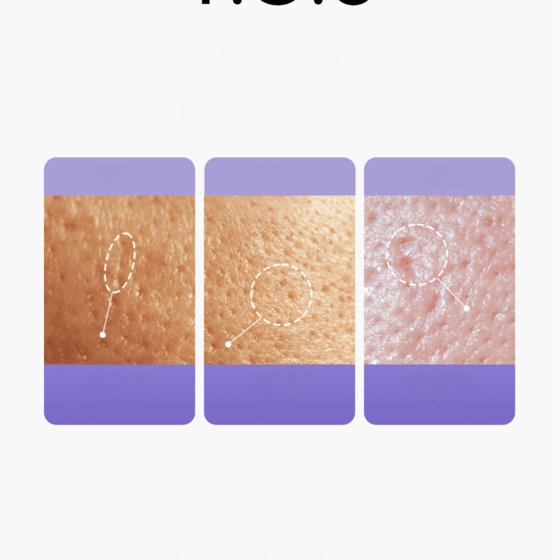 REJURAN Derma Healer Pore Tightening Ampoule