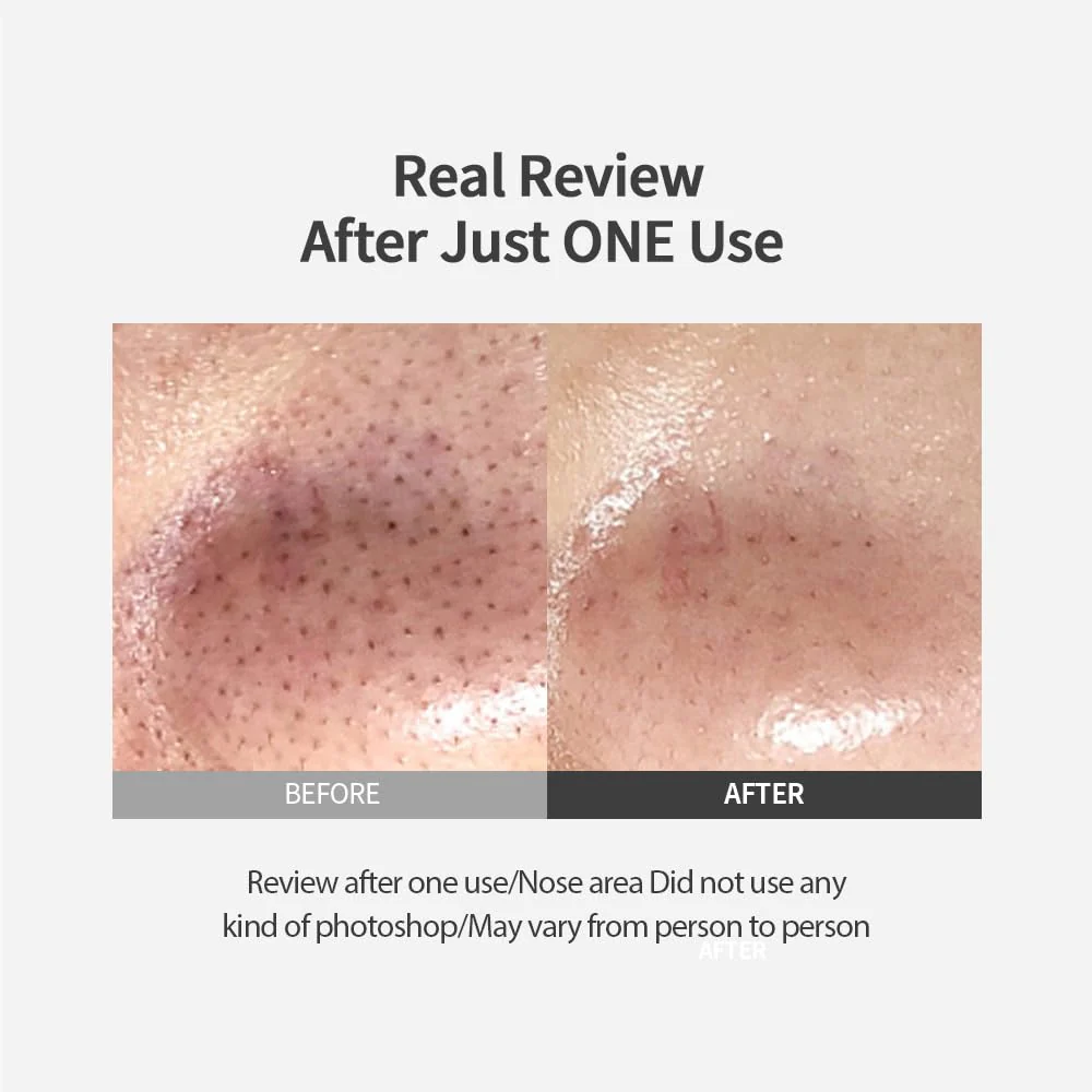 SUNGBOON EDITOR Blackhead Melting Clear Pad attīrošie diski 30gab — изображение 3